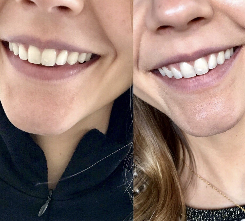 Underbrush™ Remineralizing Gum