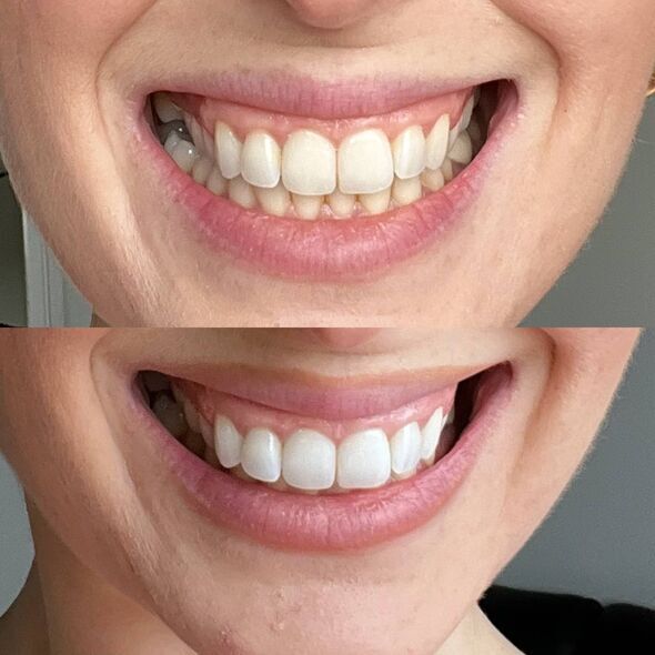 Underbrush™ Remineralizing Gum