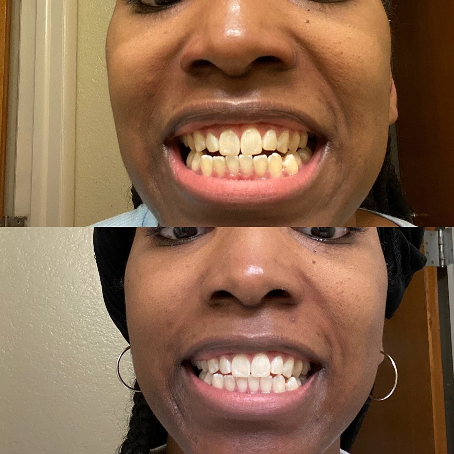 Underbrush™ Remineralizing Gum