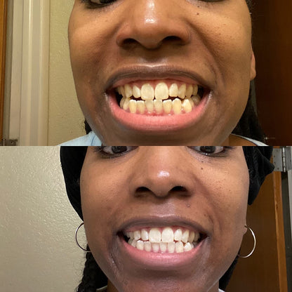 Underbrush™ Remineralizing Gum